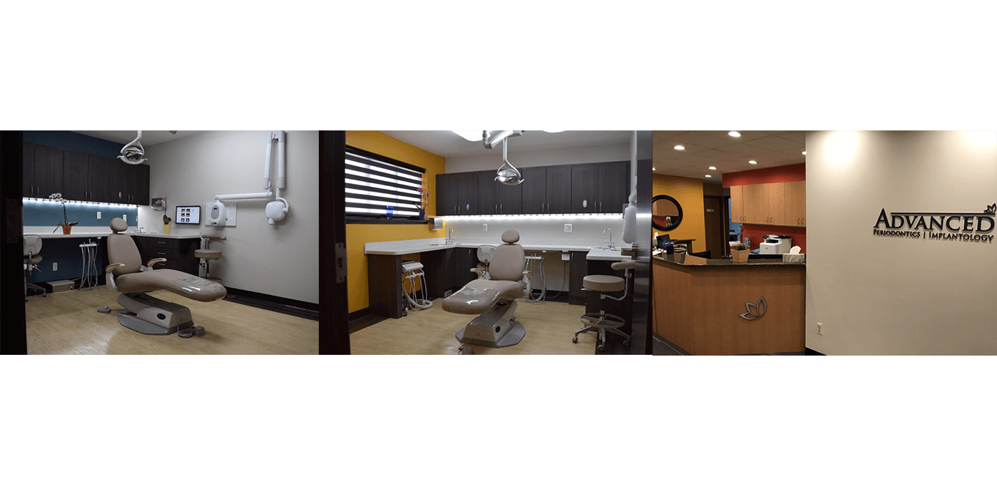 Dental Implants Treatment in Plymouth &amp; Livonia, Michigan